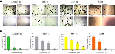 The Histone Deacetylase Inhibitor I1 Induces Differentiation of Acute Leukemia Cells With MLL Gene Rearrangements via Epigenetic Modification